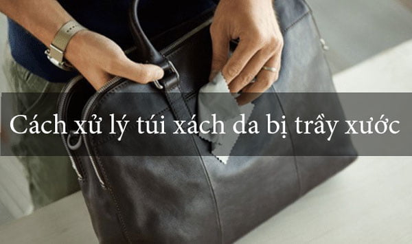 5 Cách xử lý túi da bị xước tại nhà đẹp như mới